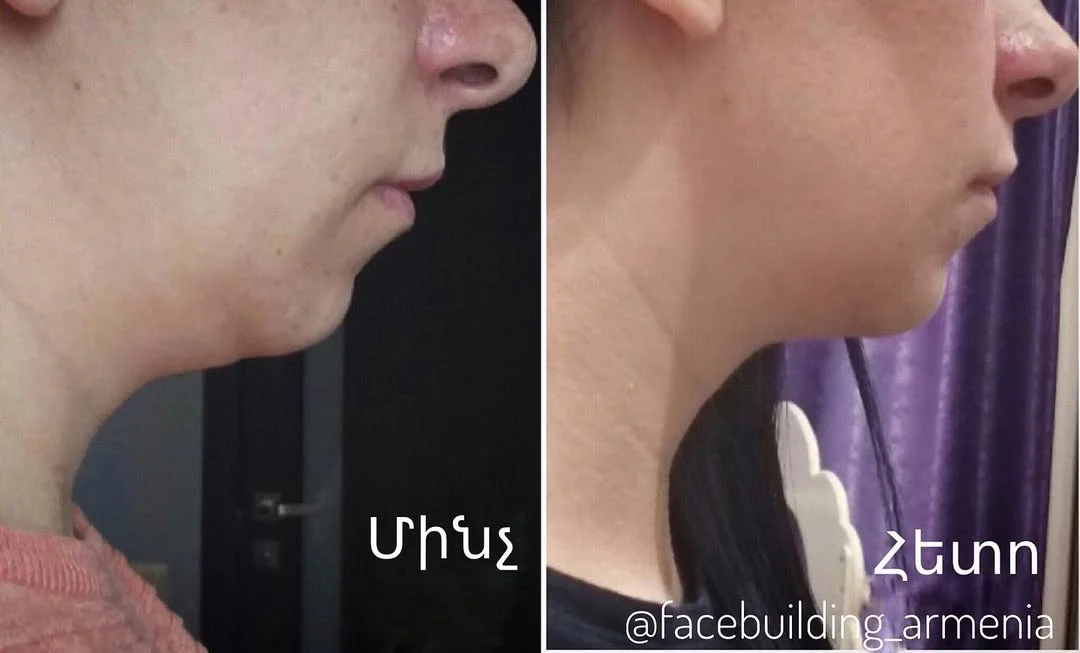 FACEBUILDBEFOREAFTER (1)