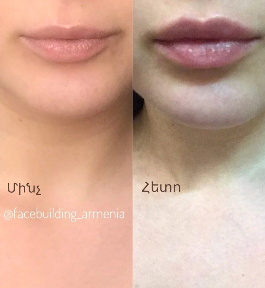FACEBUILDBEFOREAFTER (2)