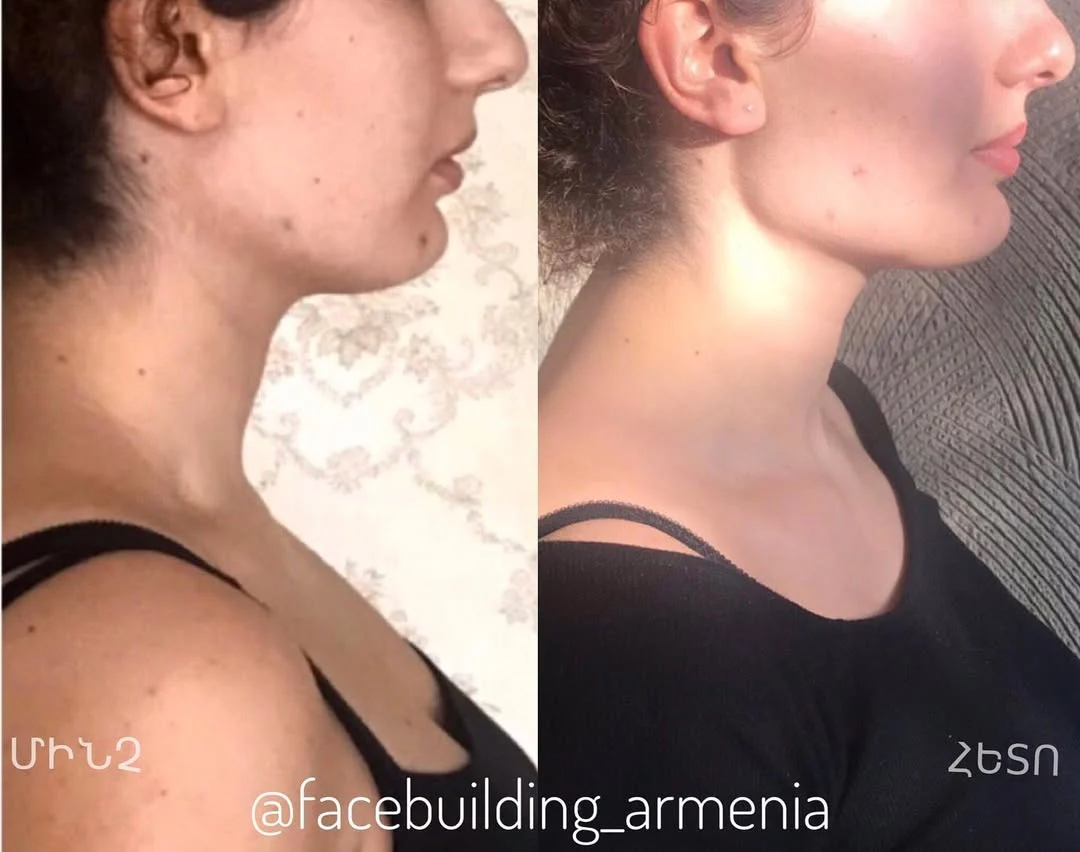 FACEBUILDBEFOREAFTER (3)