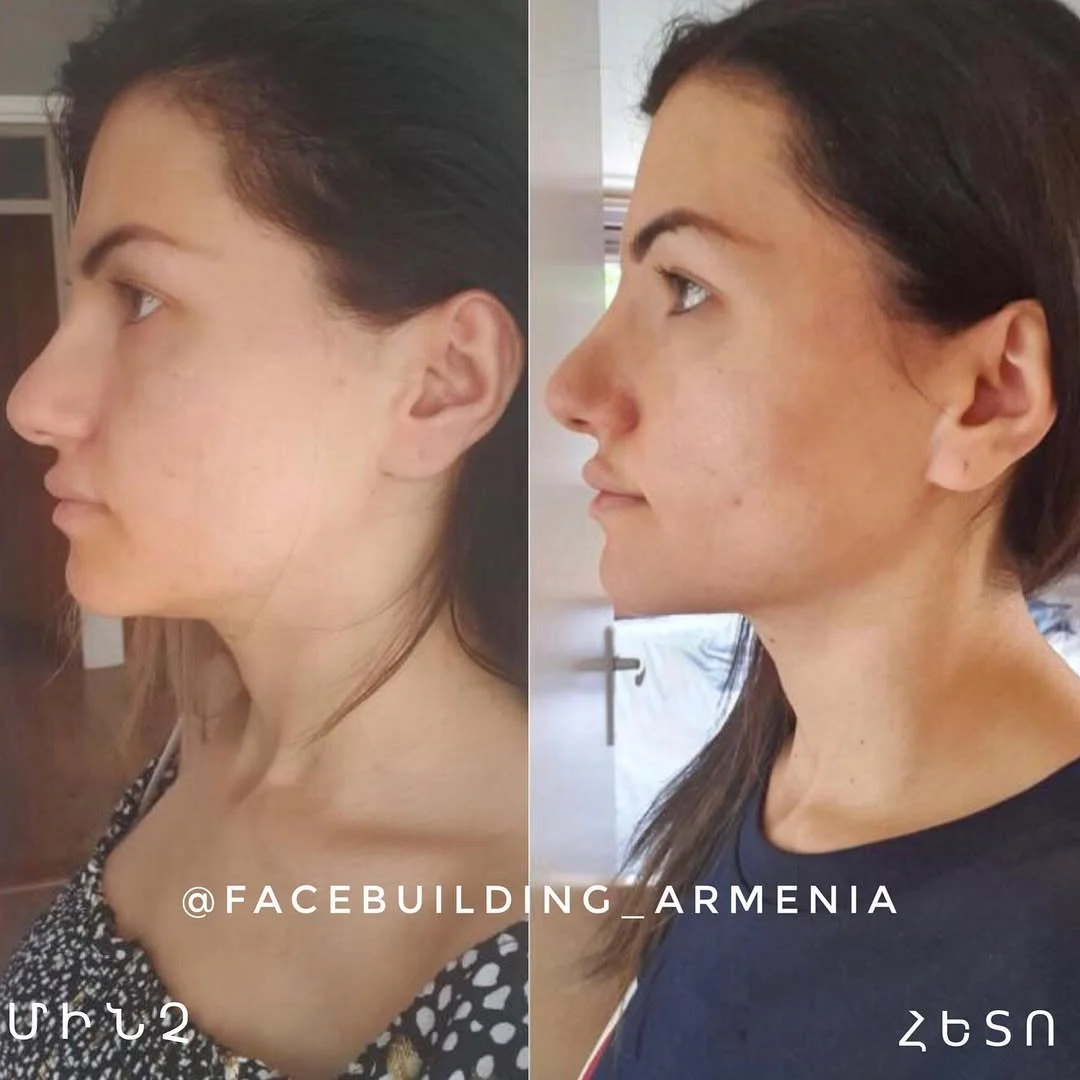 FACEBUILDBEFOREAFTER (5)