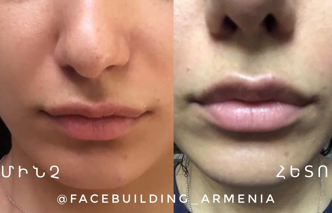 FACEBUILDBEFOREAFTER (7)