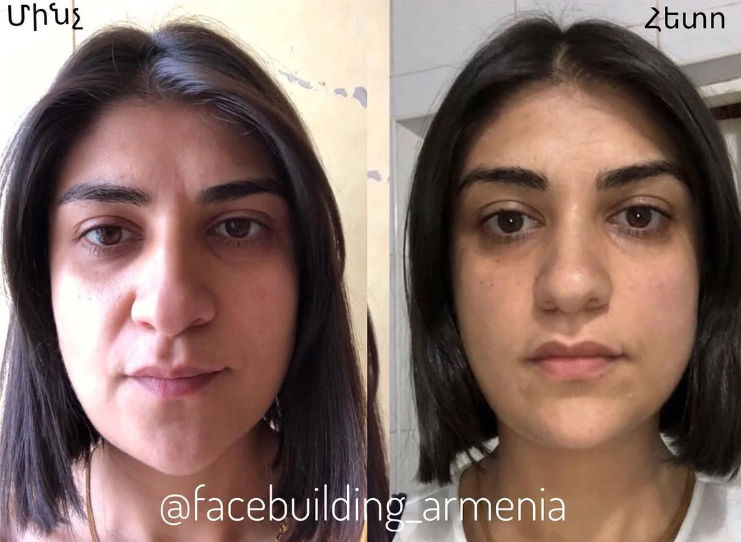 FACEBUILDBEFOREAFTER (8)